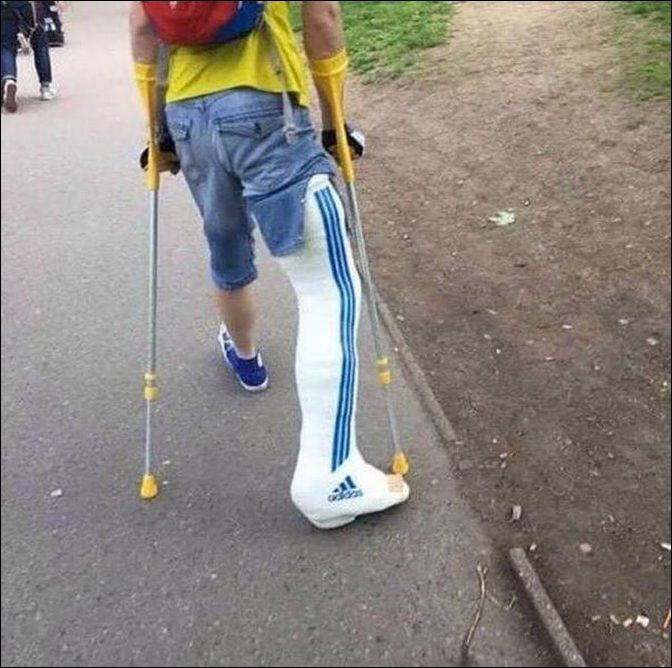 Картинки сломанная нога прикольные