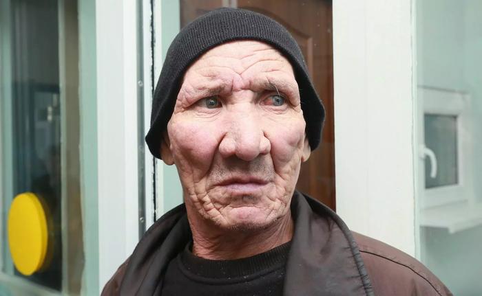 Фото бездомных разных стран.