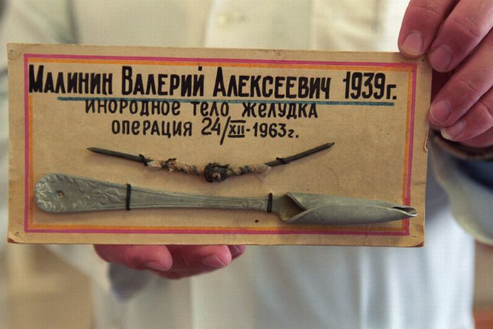 Предметы, которые были изъяты из желудка.
