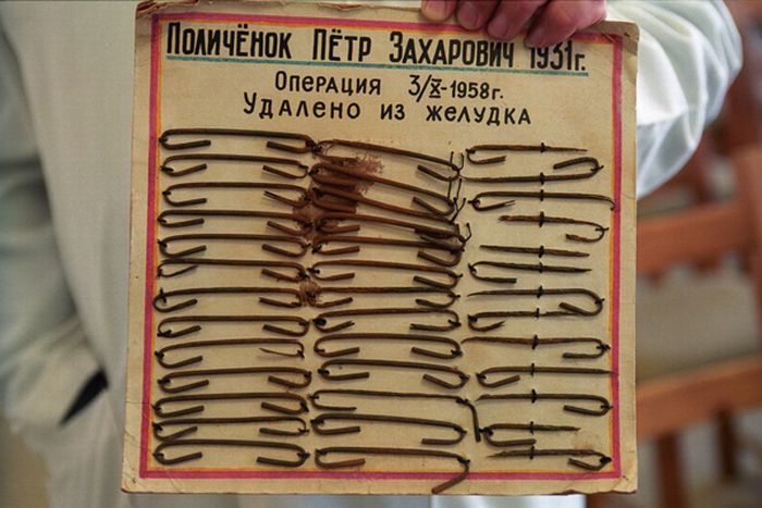 Предметы, которые были изъяты из желудка.