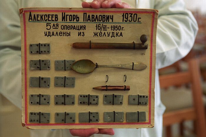 Предметы, которые были изъяты из желудка.